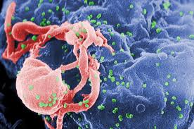 Major study calls for HIV treatment to start as early as possible